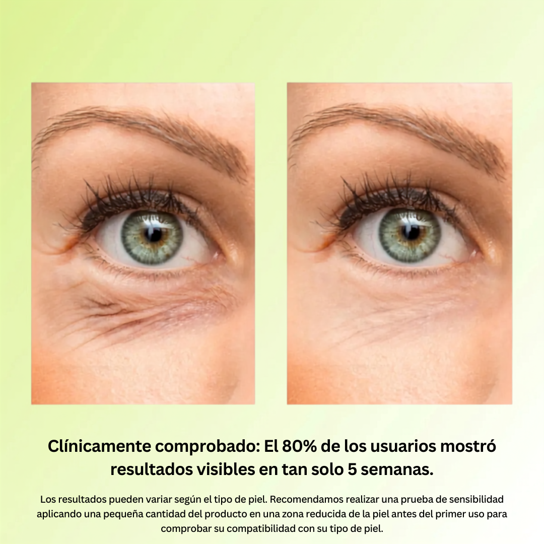 Retinal Shot by Celimax